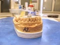 Metal-ceramic dental crown is tried on an gypsum model Royalty Free Stock Photo