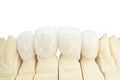 Metal free ceramic dental crowns Royalty Free Stock Photo