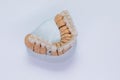 Metal free ceramic dental crowns. Close-up ceramic crowns veneers on a gypsum model. Illuminated glossy look and natural