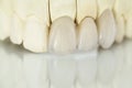Metal free ceramic dental crowns Royalty Free Stock Photo