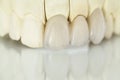 Metal free ceramic dental crowns