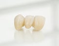 Metal free ceramic dental crowns Royalty Free Stock Photo