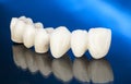 Metal free ceramic dental crowns Royalty Free Stock Photo