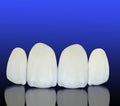 Metal free ceramic dental crowns Royalty Free Stock Photo