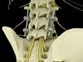 Metal pedicle fixation system in the lumbar spine isolated on black background 3d illustration Royalty Free Stock Photo