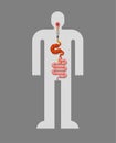 Metal stomach and intestines. Robotic internal organ. Iron digestive tract. Cyborg organs. Robot gut