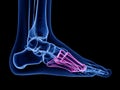 the metatarsal bone Royalty Free Stock Photo