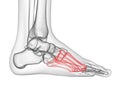 the metatarsal bone Royalty Free Stock Photo