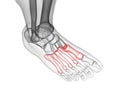 the metatarsal bones Royalty Free Stock Photo
