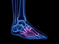 The metatarsals bone Royalty Free Stock Photo