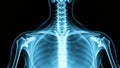 Detailed HighDefinition XRay of the Shoulder Clavicle Scapula and Humerus for Accurate Diagnostic Imaging and Medical Royalty Free Stock Photo