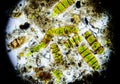 Microalgae under a microscope Royalty Free Stock Photo