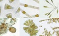 Microalgae under microscopic view, green algae, cyanobacteria, phytoplankton, diatom, algae mix collage background Royalty Free Stock Photo
