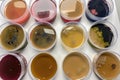 microbial cultures of different strains and species being compared side by side