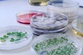Microbiological culture in a petri dish for pharmaceutical bioscience research. Concept of science, laboratory and study of