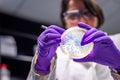 Doctor examining meningococcal bacterial culture plate