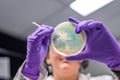 Doctor examining meningococcal bacterial culture plate Royalty Free Stock Photo