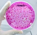 Microbiology E.coli bacteria on Culture medium