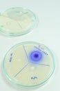 Microbiology laboratory test Royalty Free Stock Photo