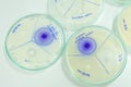 Microbiology laboratory test Royalty Free Stock Photo