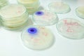 Microbiology laboratory test Royalty Free Stock Photo