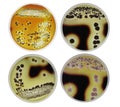 Microbiology strach agar test by bacteria