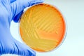 Micrococcus luteus Royalty Free Stock Photo