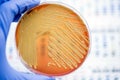 Micrococcus luteus Royalty Free Stock Photo