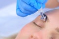 Microcurrent face treatment with hyaluronic acid gel for young woman, closeup. Royalty Free Stock Photo