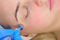 Microcurrent face treatment with hyaluronic acid gel for young woman, closeup. Royalty Free Stock Photo