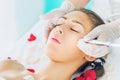 Microdermabrasion treatment