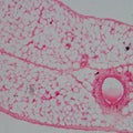 Micrograph of blood vessel, artery