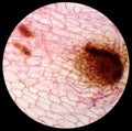 Micrograph of new sporophyte of fern leaf prothallium, background