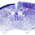 Micrograph of rat brain Royalty Free Stock Photo