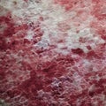 Micrograph red cherry fruit peel