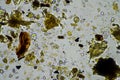 Microorganisms and biology in Compost and soil sample under the microscope Royalty Free Stock Photo