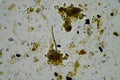 Microorganisms and biology in Compost and soil sample under the microscope Royalty Free Stock Photo