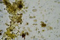 Microorganisms and biology in Compost and soil sample under the microscope Royalty Free Stock Photo