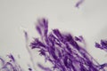 Microscope photo a bundle of Penicillium fungi
