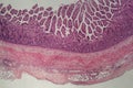 Microscope photo of a large intestine section with inflammation Colitis Royalty Free Stock Photo