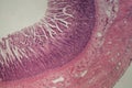 Microscope photo of a large intestine section with inflammation Colitis Royalty Free Stock Photo