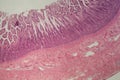 Microscope photo of a large intestine section with inflammation Colitis Royalty Free Stock Photo