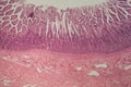 Microscope photo of a large intestine section with inflammation Colitis Royalty Free Stock Photo