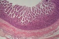 Microscope photo of a large intestine section with inflammation Colitis Royalty Free Stock Photo