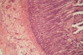 Microscope photo of a large intestine section with inflammation Colitis Royalty Free Stock Photo