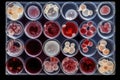 microscope slide of blood cells, with various details visible