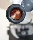 Microscope view of aerobic fungi - Aspergillus niger. Selective focus on the eyepiece