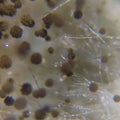 Microscopic View Of Aspergillus Niger Mold