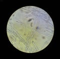 Microscope view of fungi mycelium filaments 40x increase Royalty Free Stock Photo