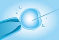 Microscopic artificial insemination, In vitro fertilisation IVF